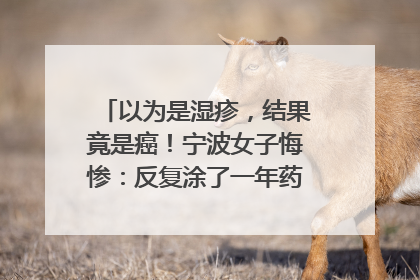 以为是湿疹，结果竟是癌！宁波女子悔惨：反复涂了一年药膏都没好！很多患者首诊都去了皮肤科